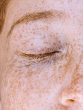 Vitamin C Serum – Brightening & Anti-Dark Spots